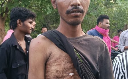 ମାନସିକ ରୋଗୀ କୁ ପିଲାଚୋର ସନ୍ଧେହ ରେ ଗୁଜବ.